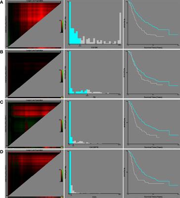 Adjusting CA19-9 values with clinical stage and bilirubin to better predict survival of resectable pancreatic cancer patients: 5-year-follow-up of a single center